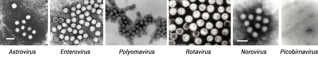virus san roque 