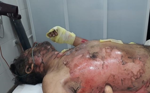 Hector Corvalan Campesino herido