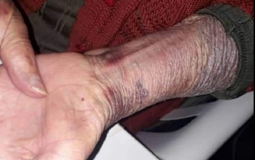 Maltratos abuela de Obispo Trejo 01Gentileza El Diario del Pueblo