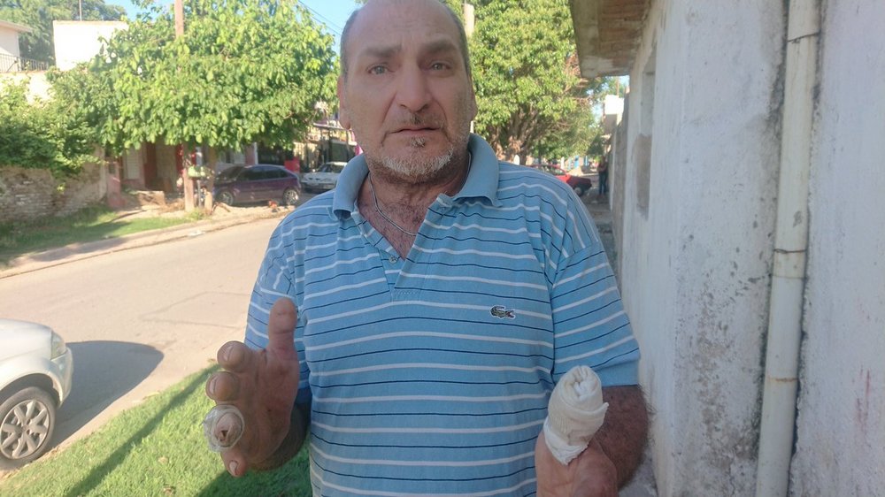 dueño de pitbull