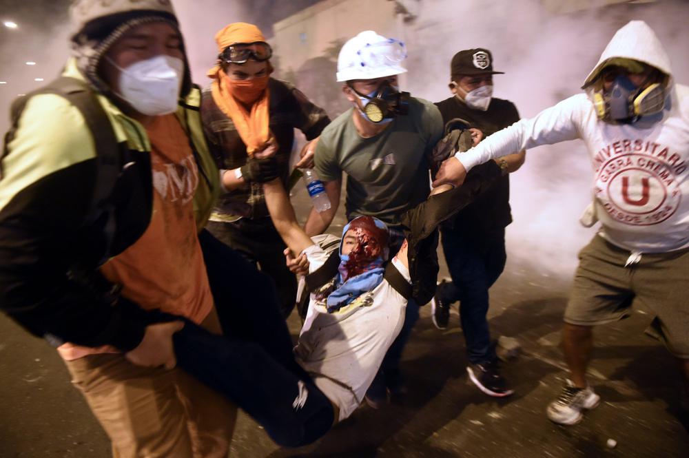 Portestas pERÚ afp
