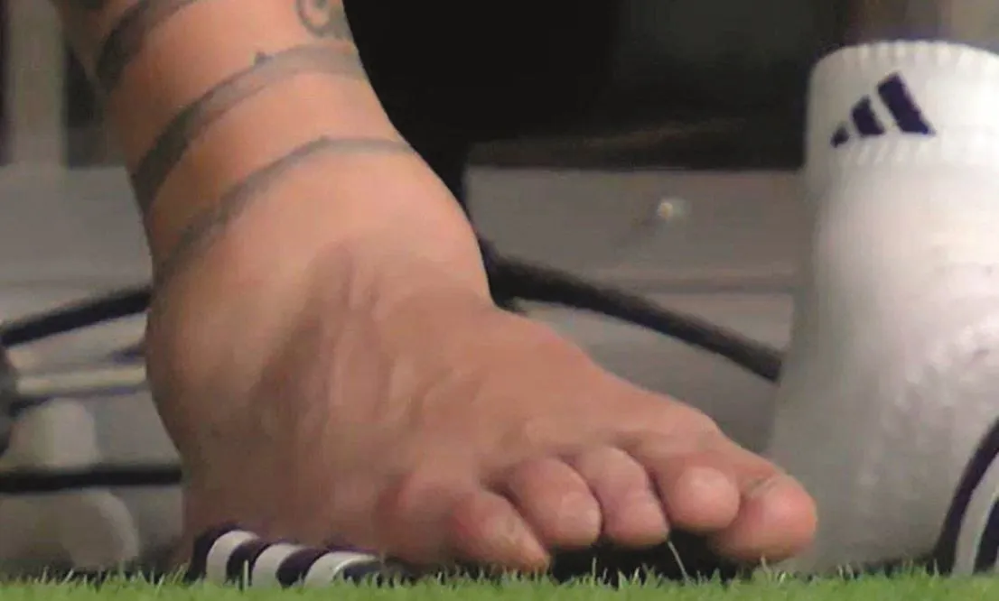 El tobilo de Messi Foto gentileza
