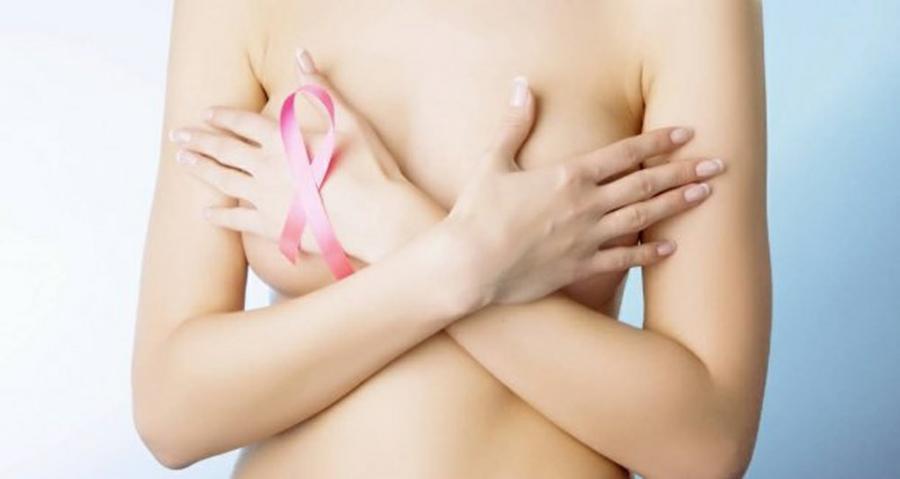 cancer de mama