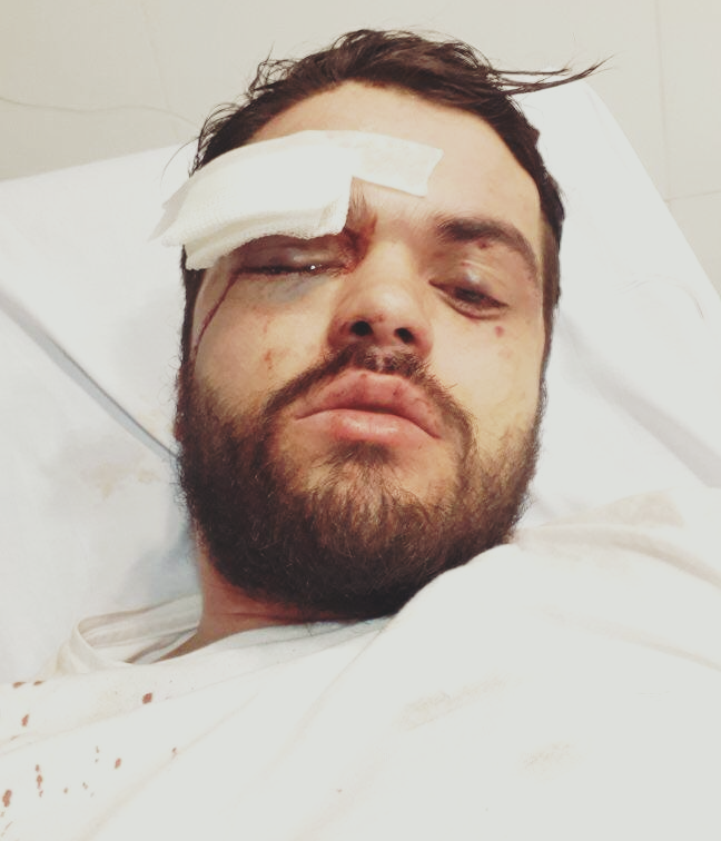 Jhonatan Castellari rugbier golpeado