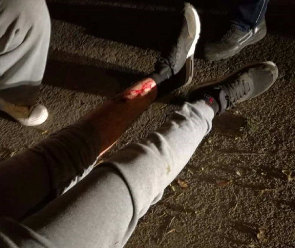 herido en ciudad universitaria por Facebook Marcha de la Gorra
