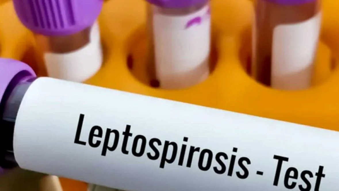 LEPTOSPIROSIS prensa.cba