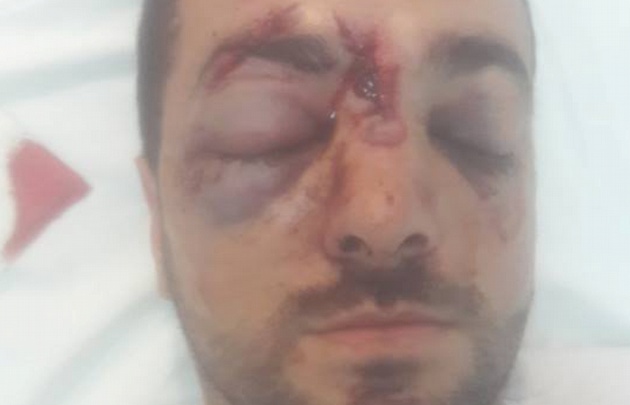 hombre golpeado