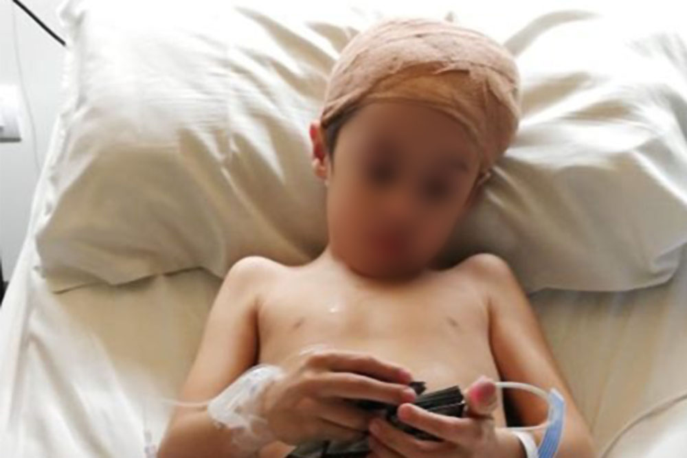 Niño accidentado 2