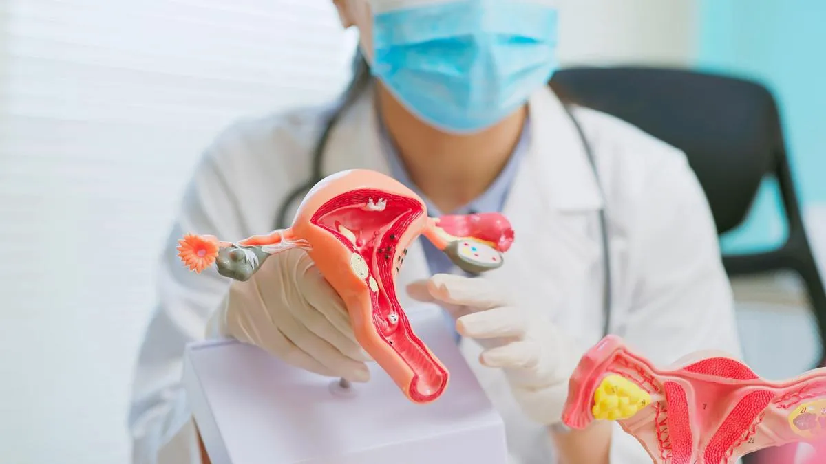 cancer de endometrio
