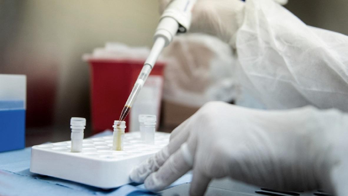 Italia inicia los ensayos en humanos de una vacuna contra el ...