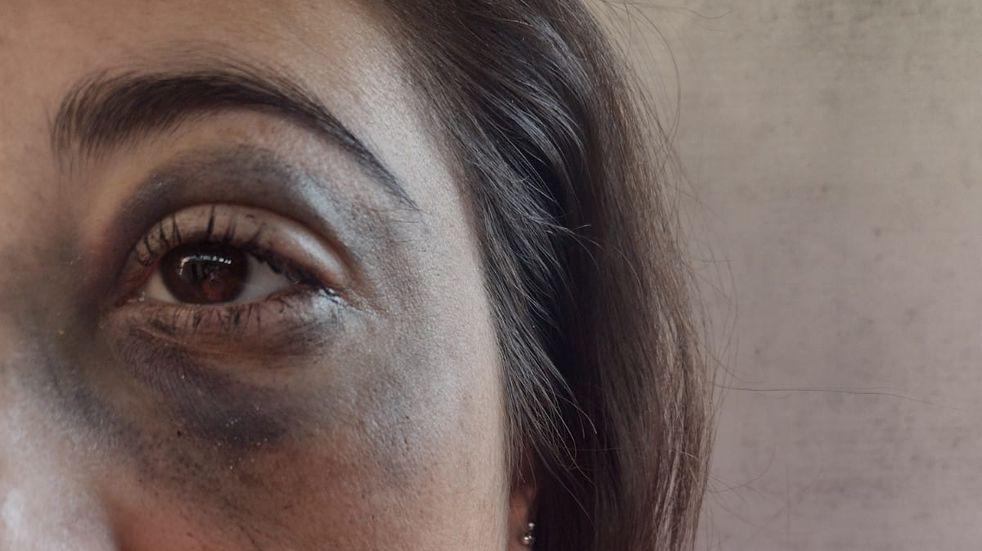 VIOLENCIA POLICIAL