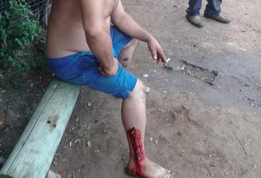 herido balas comedor Villa la Tela