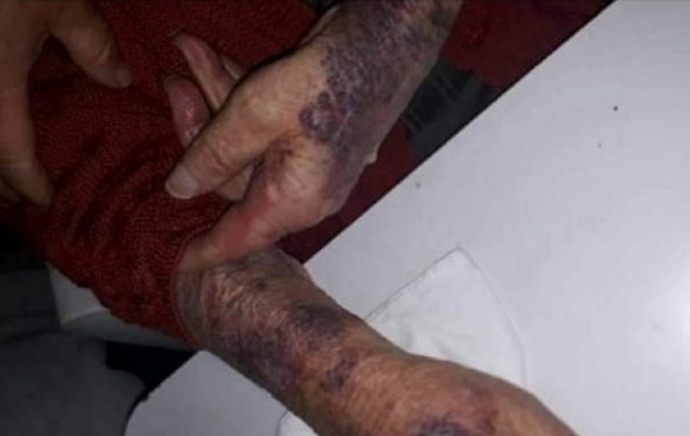 Maltratos abuela de Obispo Trejo gentileza El Diario del Pueblo