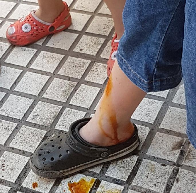niño herido protesta taxistas