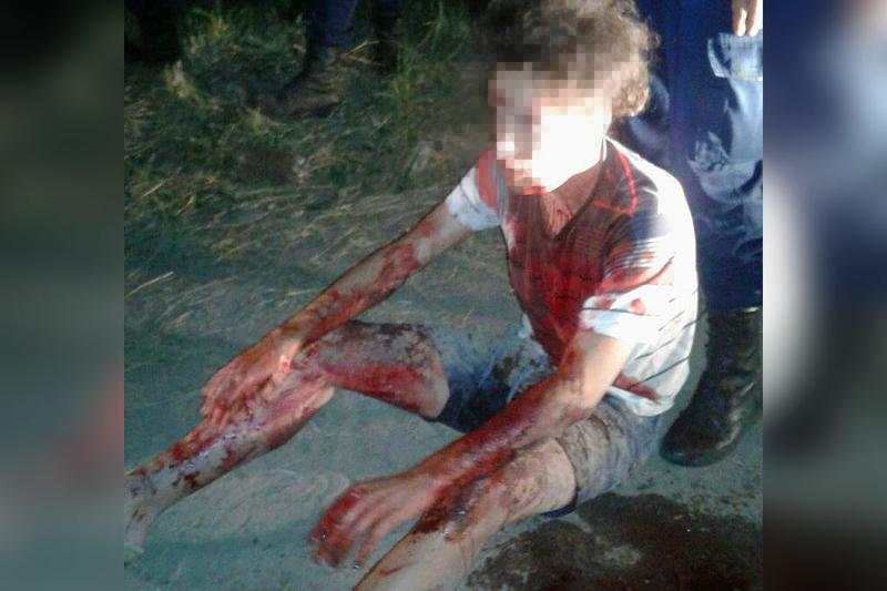Herido_01