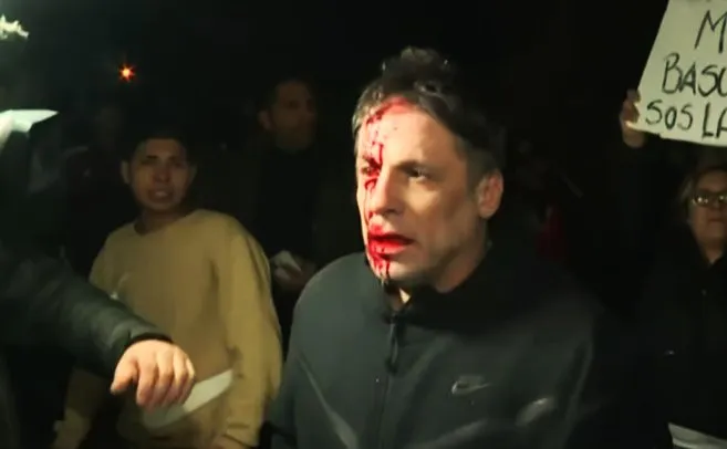 Periodista herido en acto de Milei (gentileza)