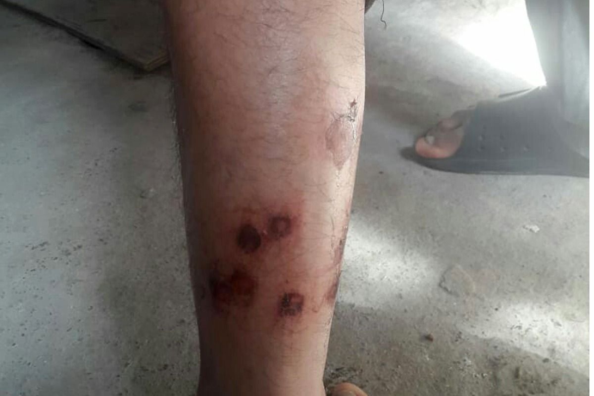 represión ctep orellana