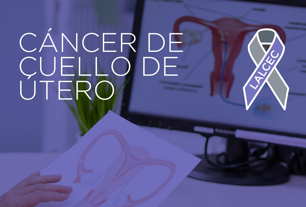 Afiche UTERO