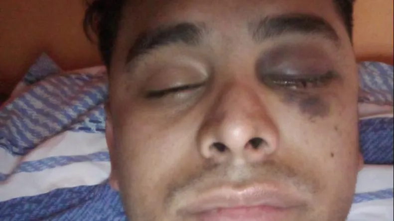 ataque en Huerta Grande