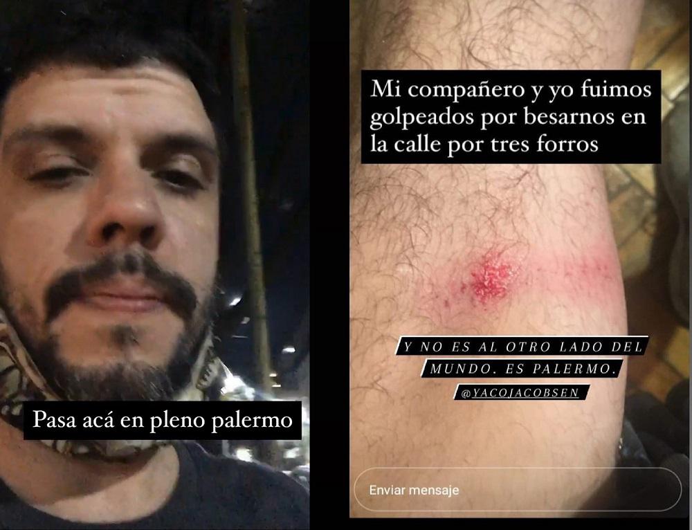 ataque homofobico