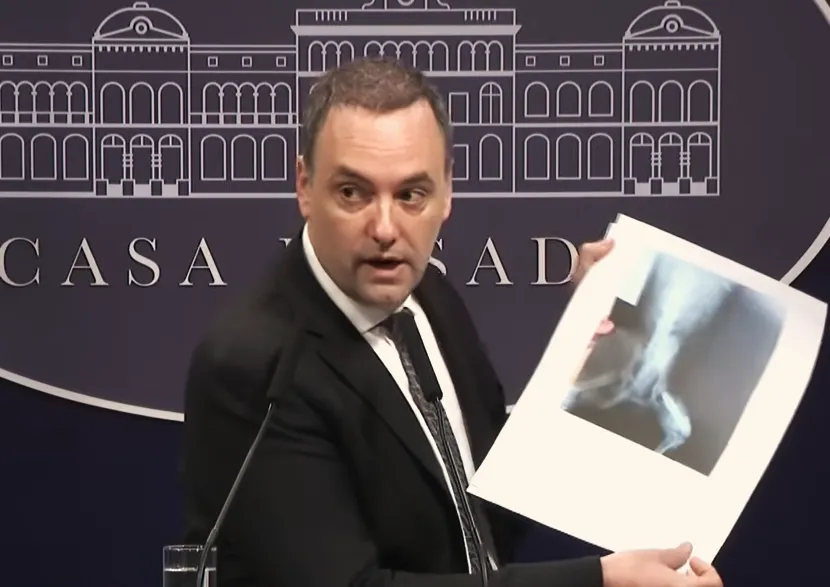 Conferencia de prensa Manuel Adorni radiografía del perro (captura)