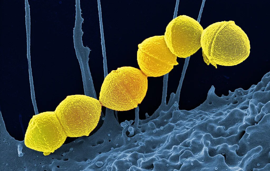Streptococcus_Pyogenes
