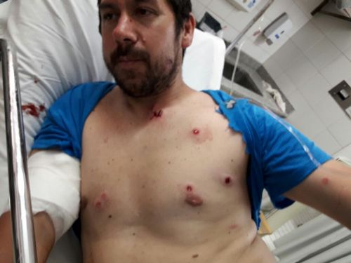 herido neuquen