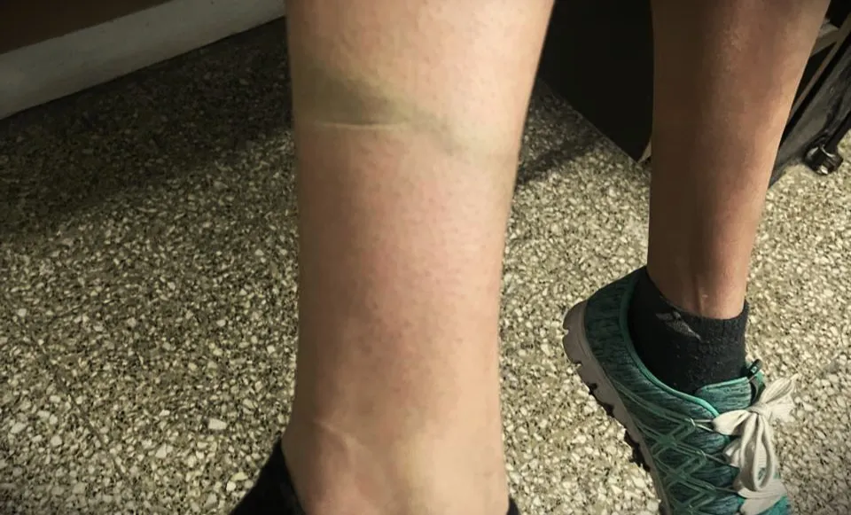 Mujer lesionada rescatada del cautiverio (Policía)