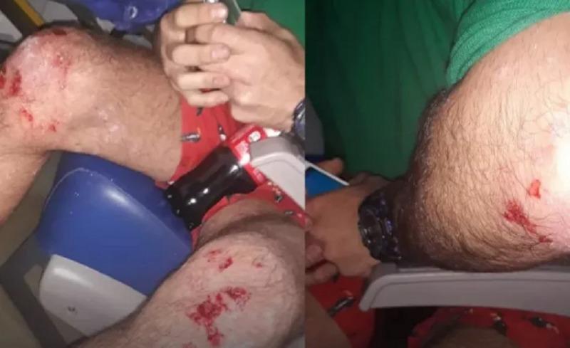 ataque homofóbico en villa urquiza by gentileza