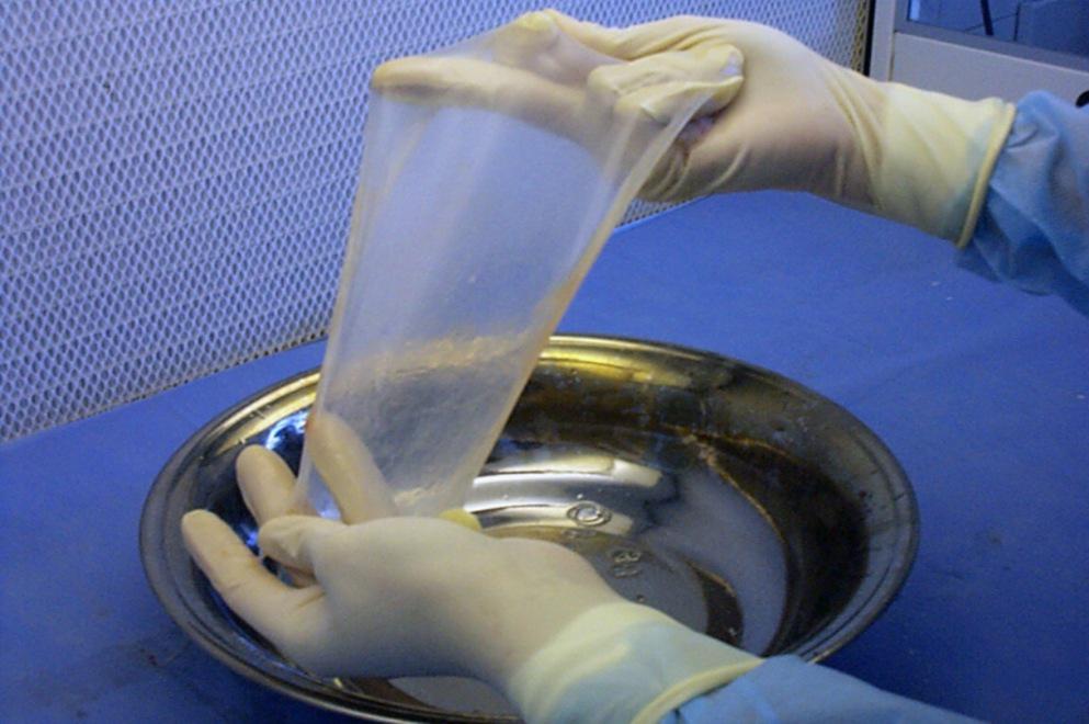 donación de placenta by gentileza