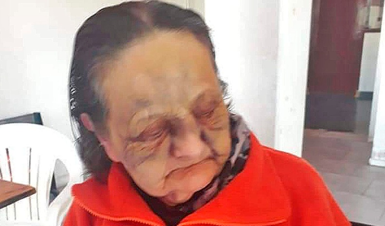mujer golpeada en general cabrera by Puntal