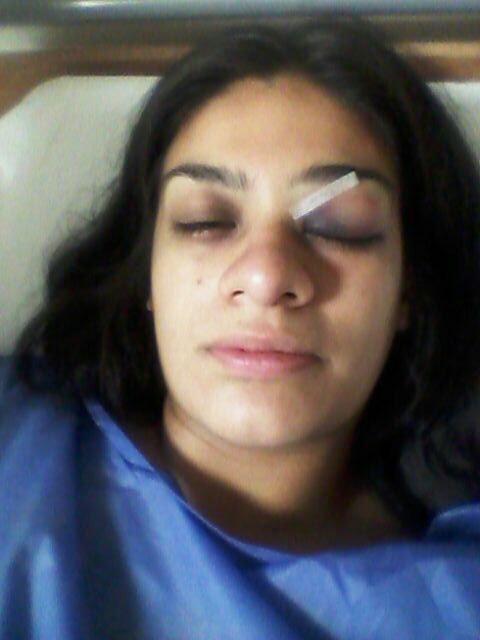 policia golpeada