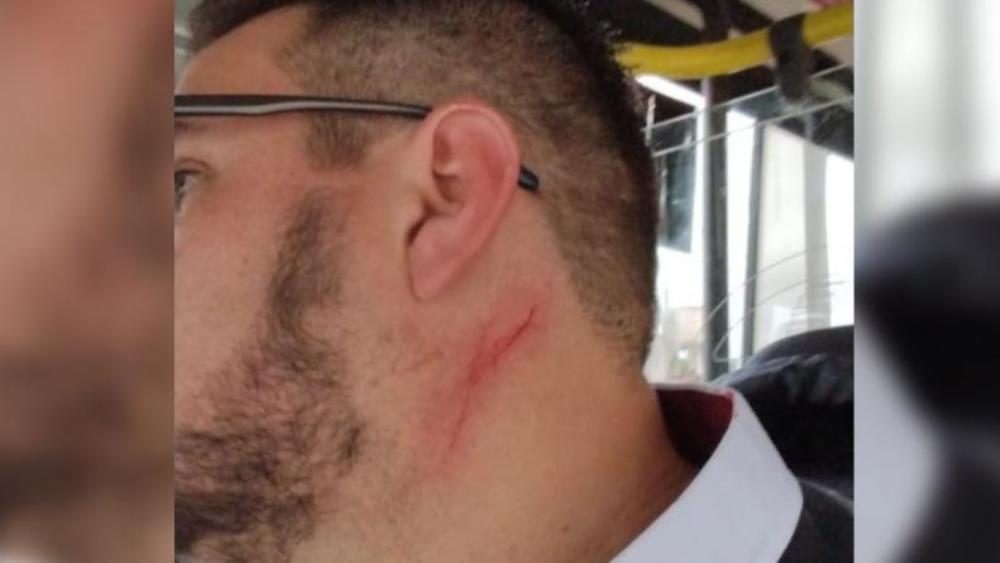 Chofer agredido Ersa by El Doce